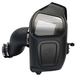 S&B FILTERS 75-5132D COLD AIR INTAKE KIT (DRY FILTER